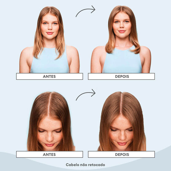 CHARCOAL+TEA TREE TRT 1OZ